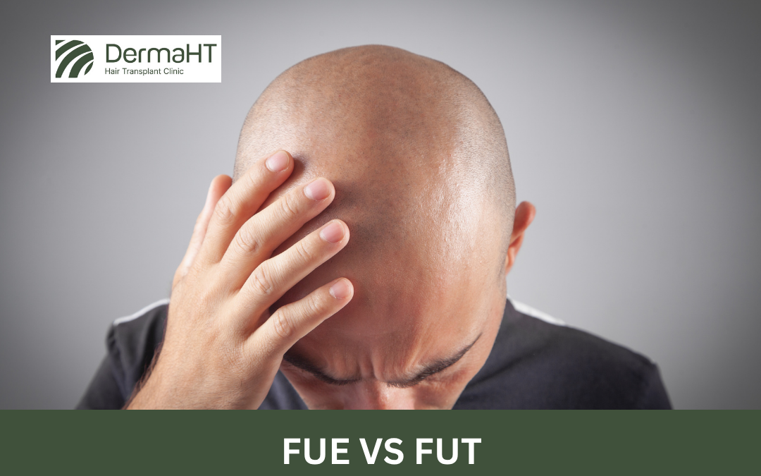 FUE vs FUT Hair Transplant: What’s the Difference and Which One Should You Choose?