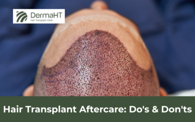 Hair Transplant Aftercare: Do’s & Don’ts
