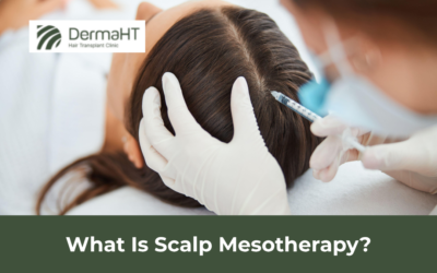 What Is Scalp Mesotherapy?