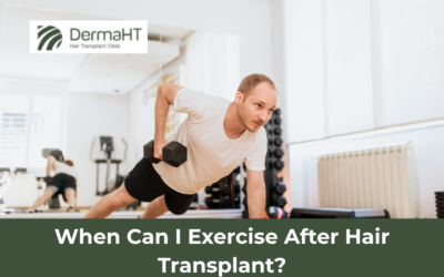 When Can I Exercise After Hair Transplant?