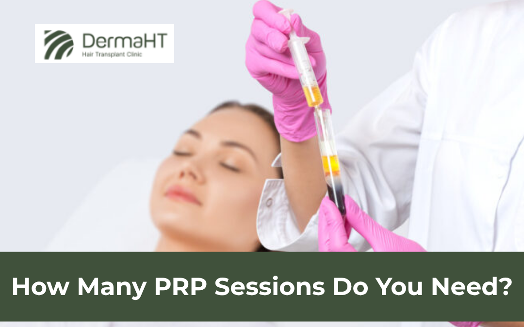 How Many PRP Sessions Do You Need