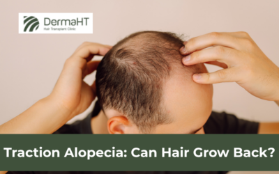 Traction Alopecia: Can Hair Grow Back?