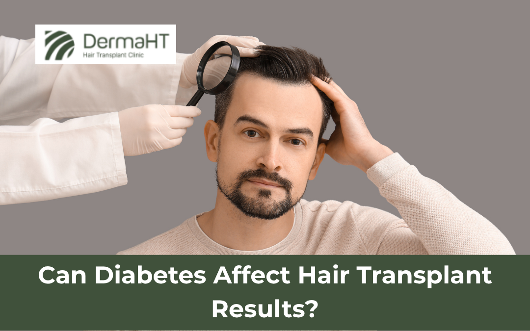 Can Diabetes Affect Hair Transplant Results