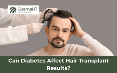 Can Diabetes Affect Hair Transplant Results?