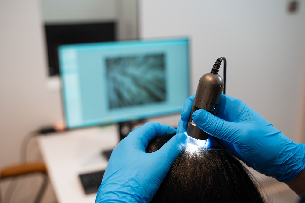 Trichoscopic Scalp Anlaysis